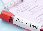 تغییر الگوی انتقال اچ‌آی‌وی در کشور از اعتیاد تزری